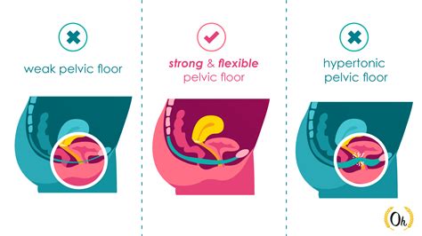 pompoir|Pelvic Floor Health Guide 